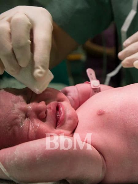 accoucher par cesarienne traumatisme enfant soin bebe naissance difficile maman enceinte grossesse compliquee bebymaman Nouveau-né en pleurs pris en charge après une césarienne à la maternité