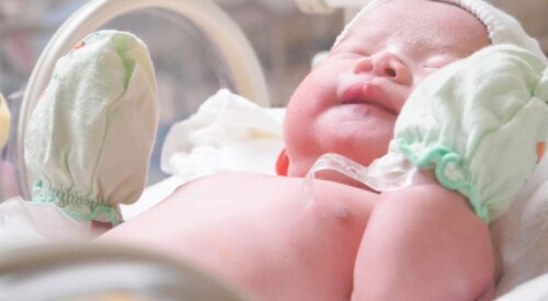 Nouveau-né en maternité avec tétine, respiration de bébé surveillée après une laryngomalacie