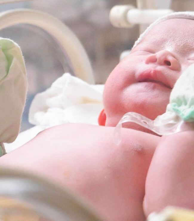 Nouveau-né en maternité avec tétine, respiration de bébé surveillée après une laryngomalacie